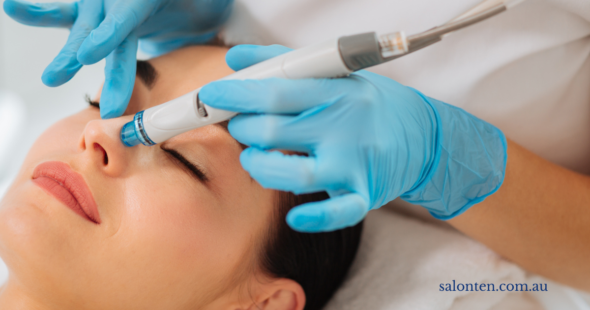 Hydrodermabrasion handpiece being used across the forehead during an Aquaglow Hydra Facial