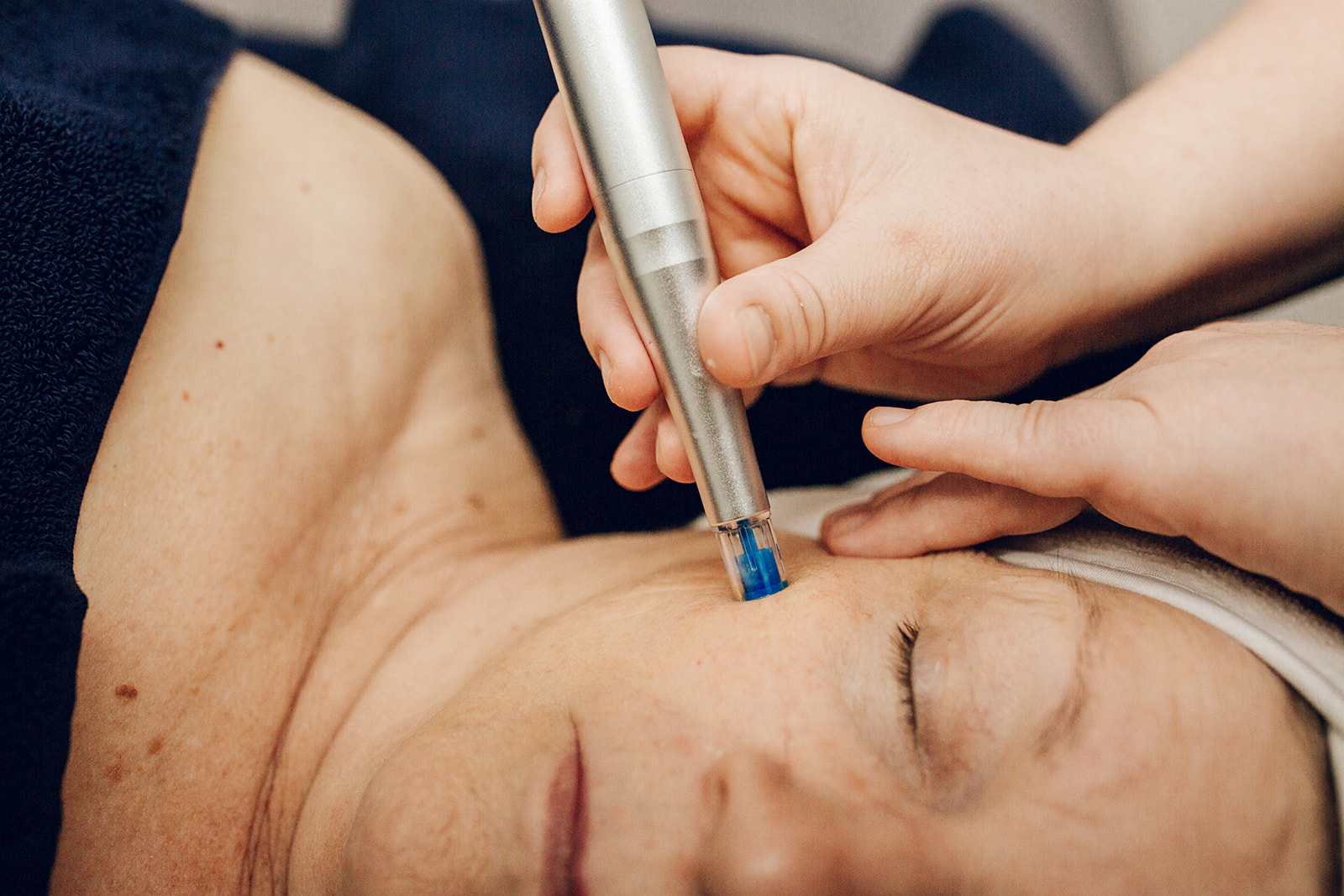 Nano Infusion Facial with the Rezenerate skin wand